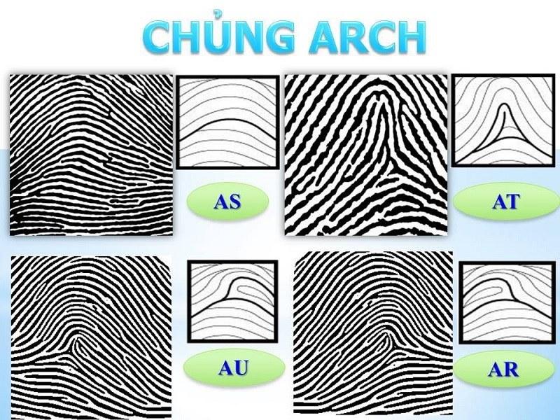 Chủng Arch (Chủng núi)