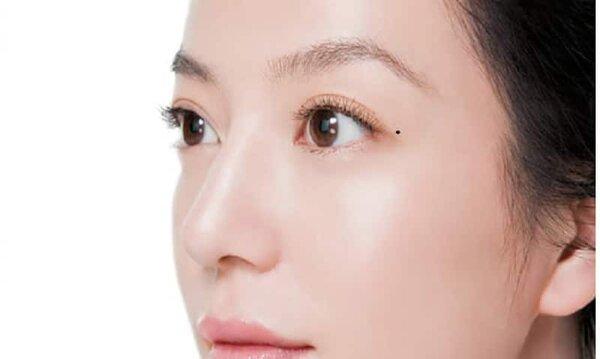 Nốt ruồi trên mí mắt trái phải, nam nữ có ý nghĩa gì? Tốt hay xấu