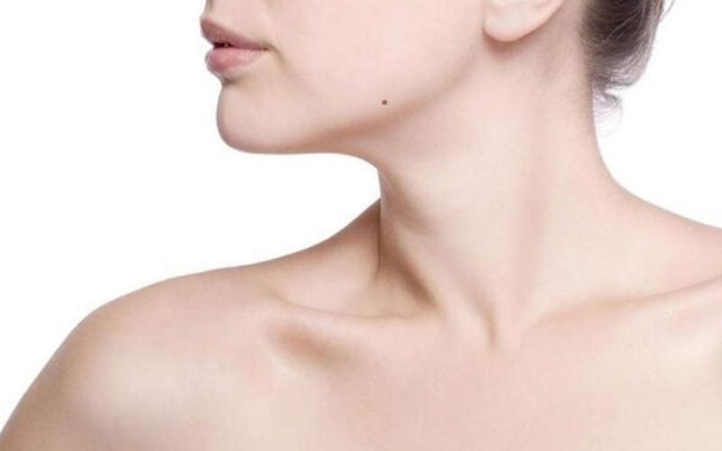 Nốt ruồi ở giữa xương quai hàm nữ