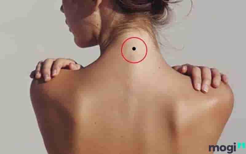 Nốt ruồi sau gáy có ý nghĩa như thế nào? Vận mệnh của người có nốt ruồi sau gáy